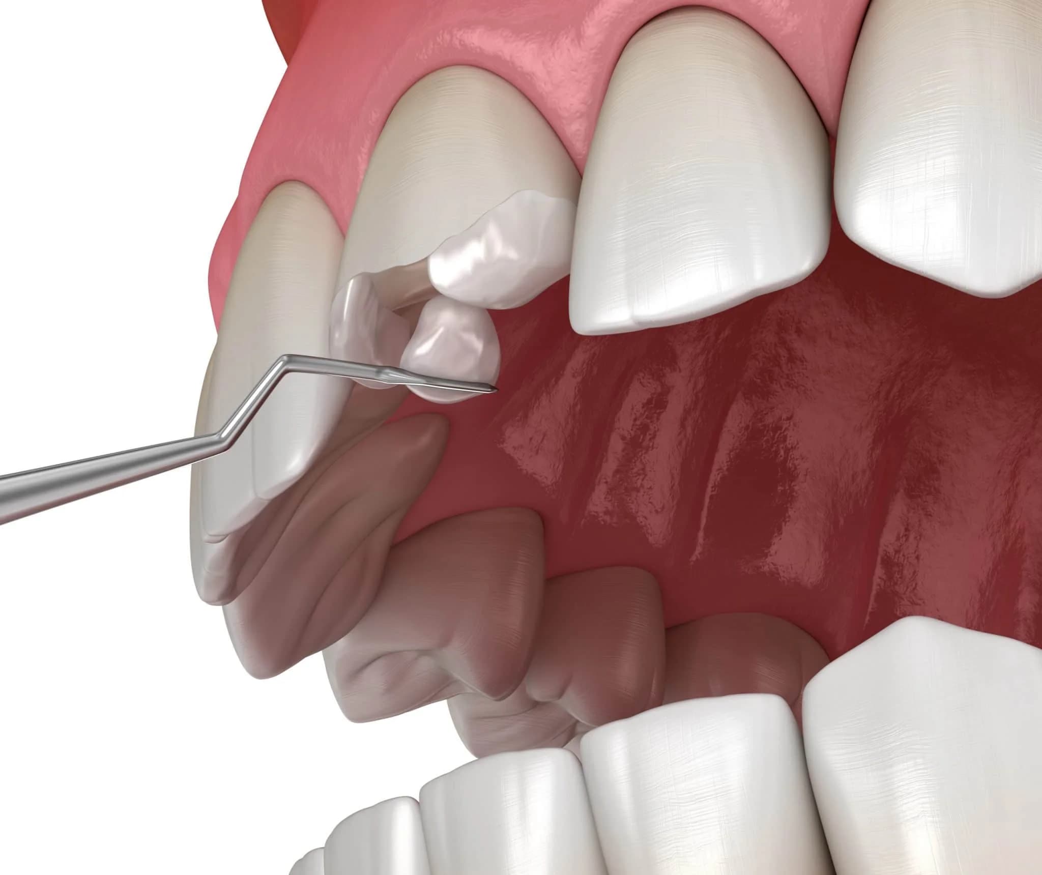 Restorative dentistry