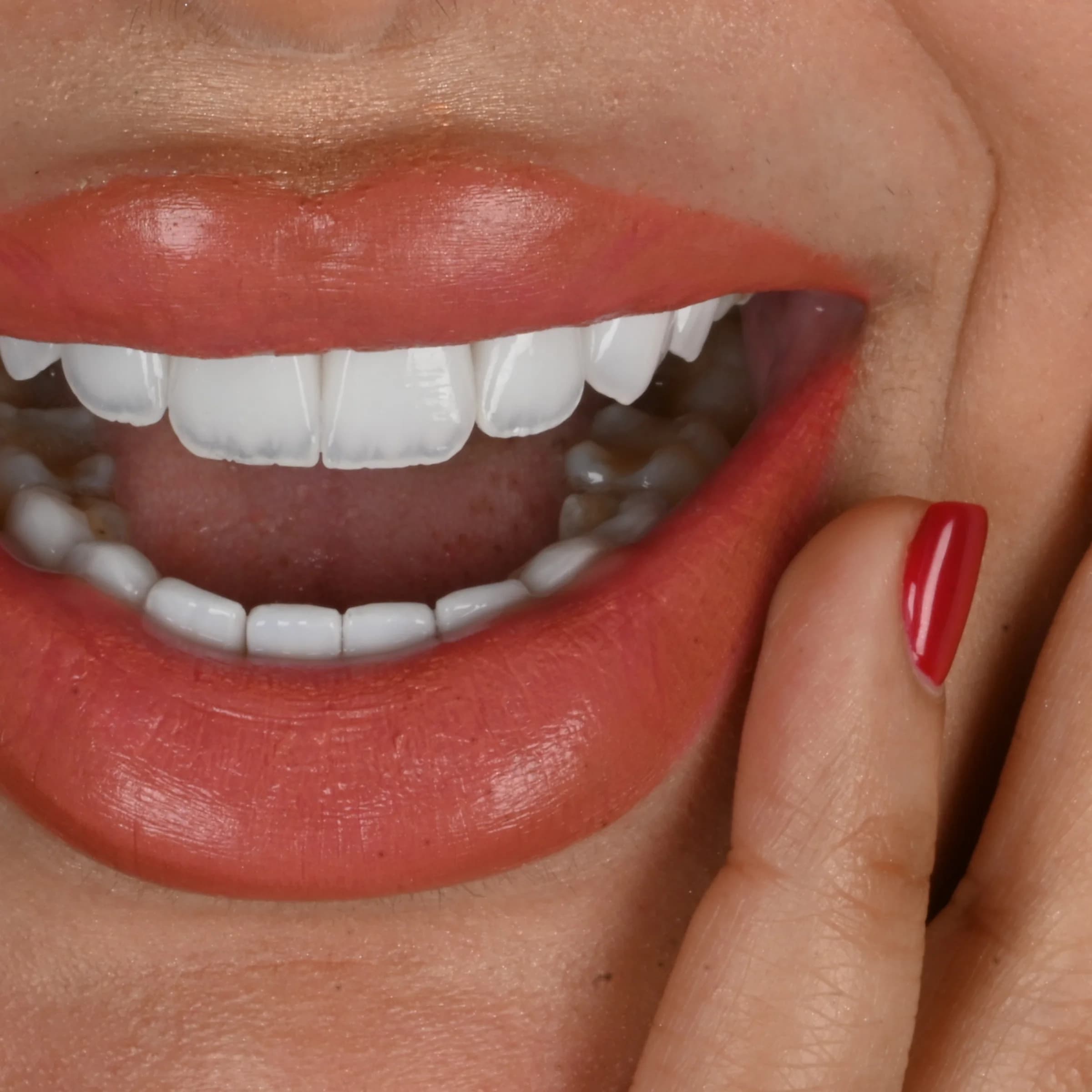Porcelain veneers, upper and lower — photo 1
