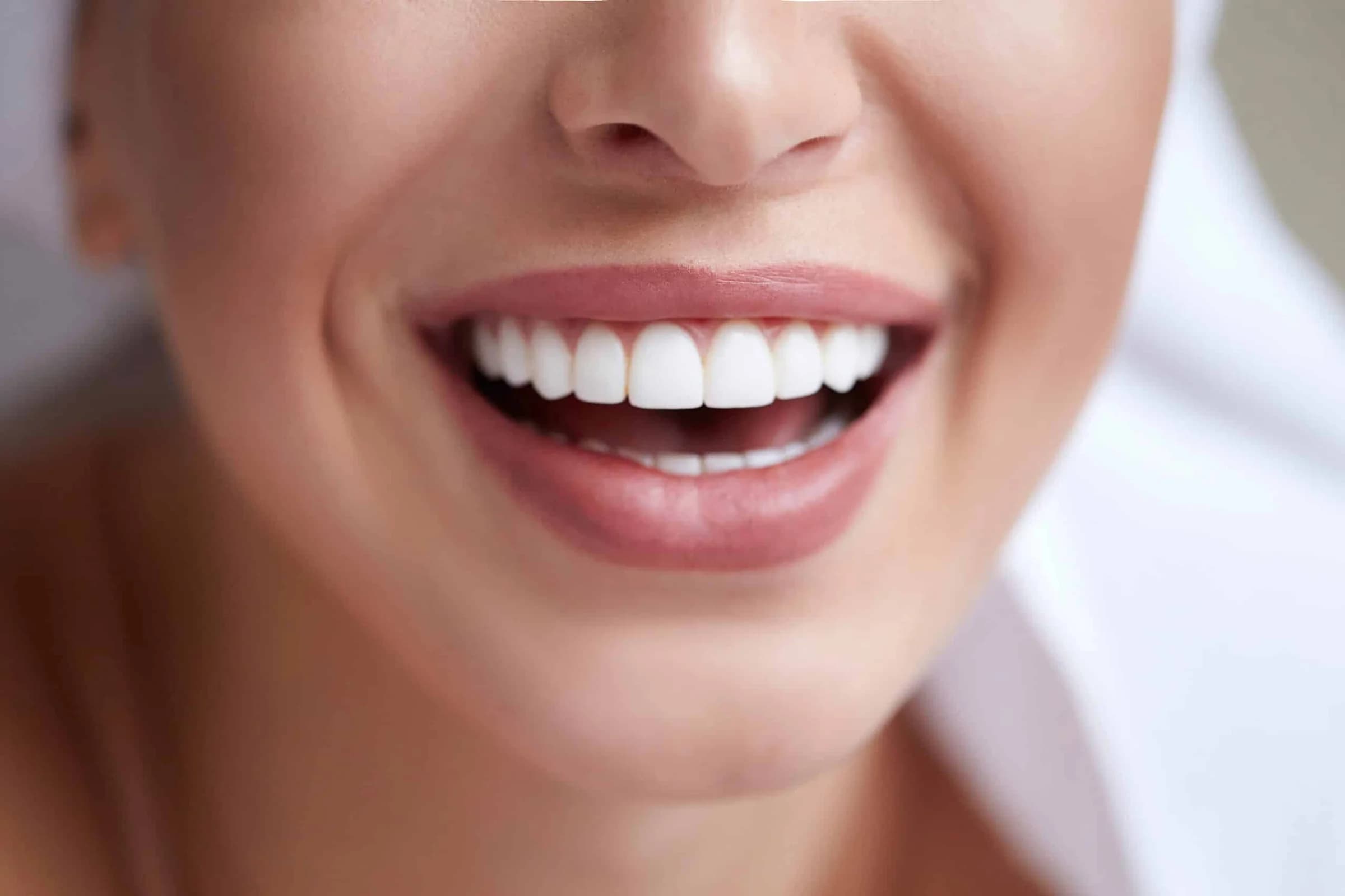 Digital Smile Design